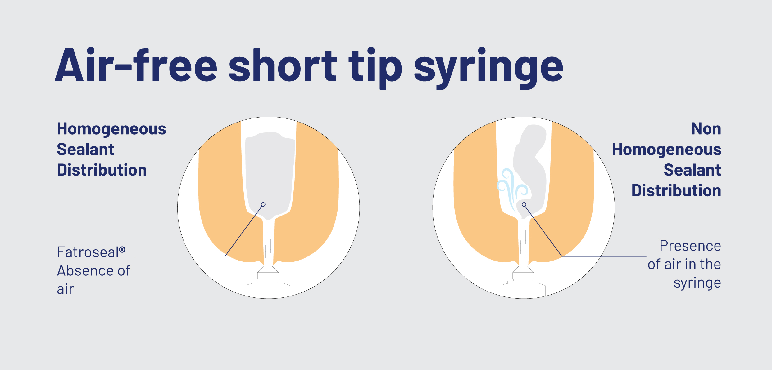 Air-Free Short Tip Syringe